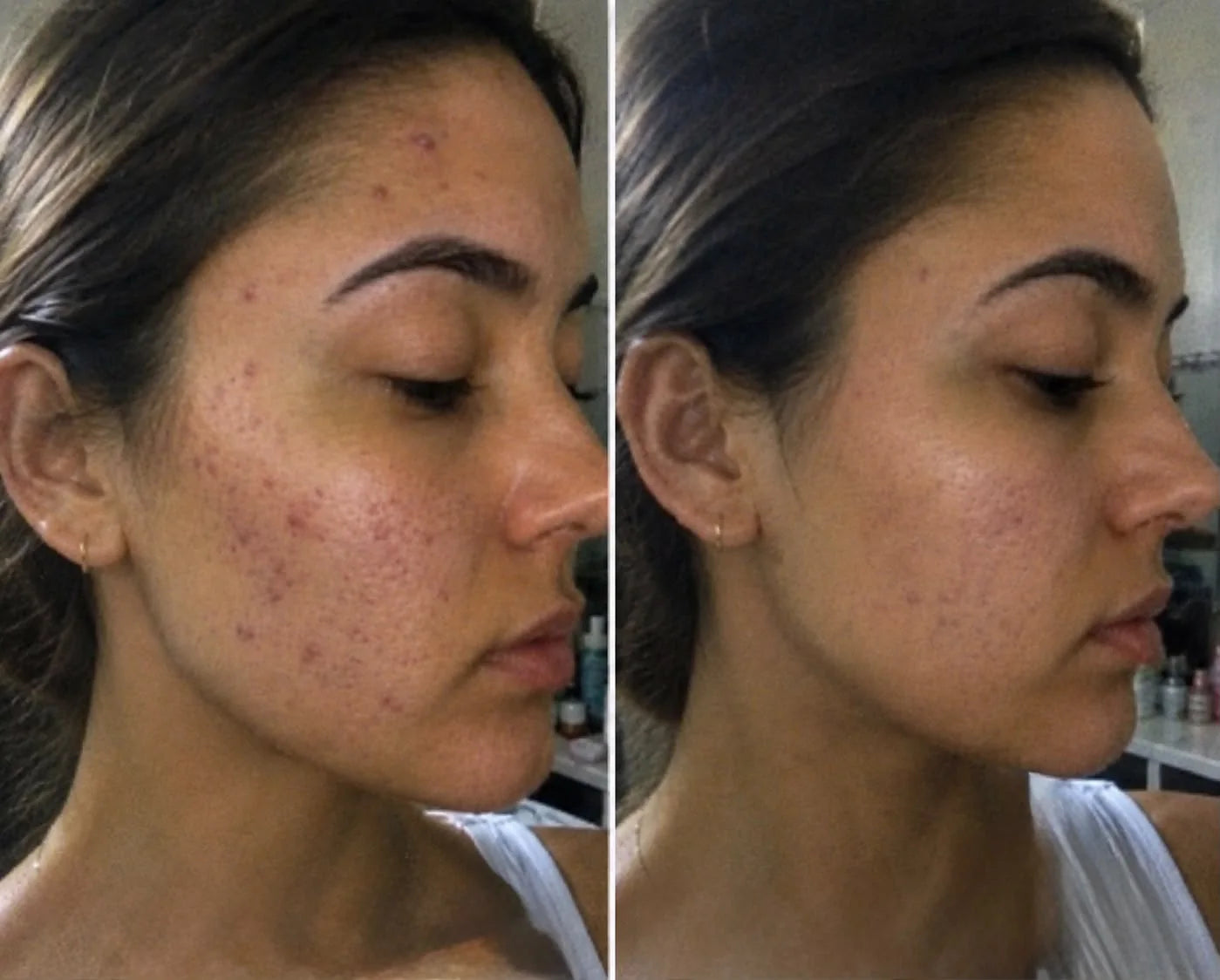 A customer photographed before and after taking PWRRR Beauty Collagen daily. Clearer, more even skin across the cheek and jaw in the second photograph.
